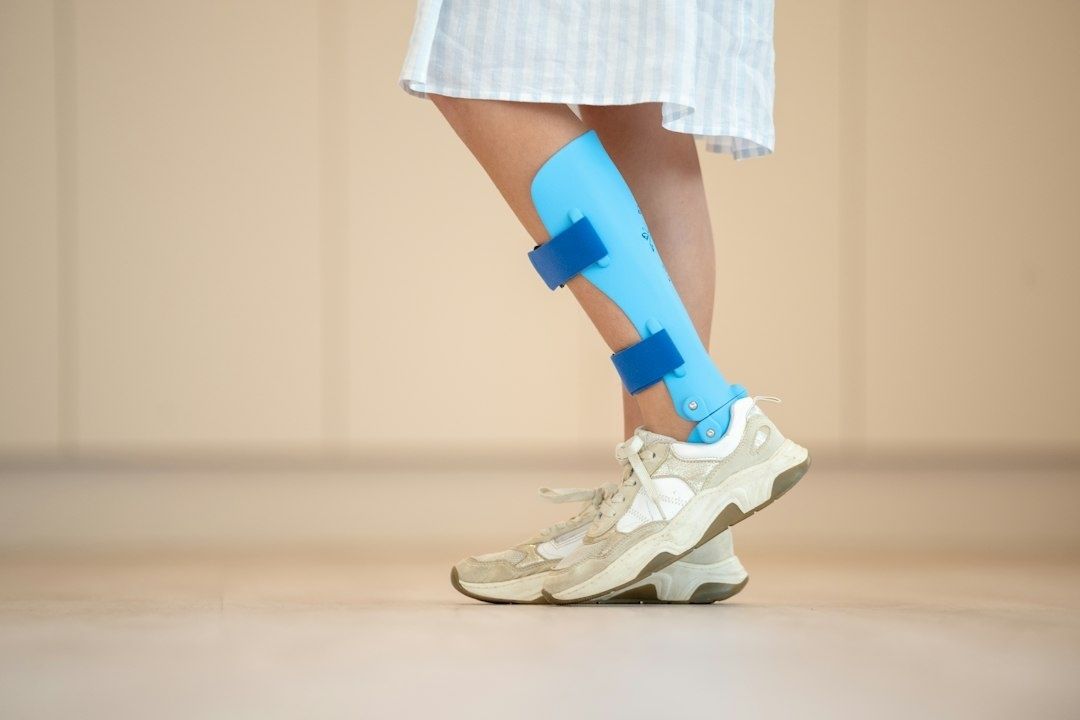 Unterschenkel mit blauer Stabilisierungsschiene und Sportschuhen